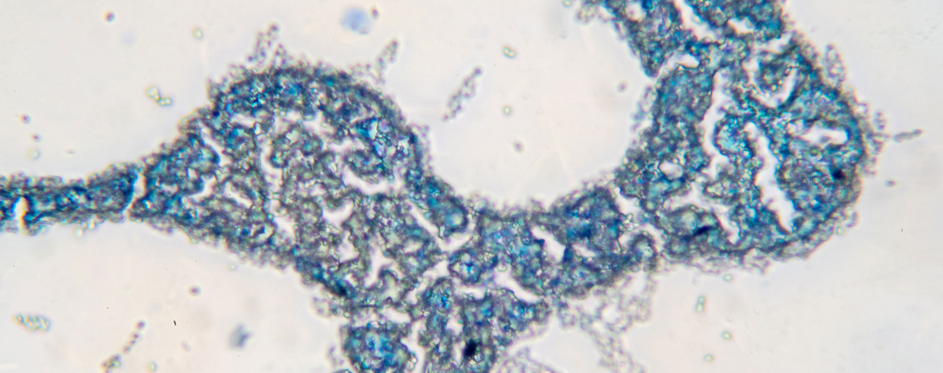 Experiments with yeasts